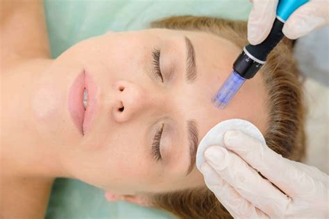 Microneedling snoqualmie  Renuva is better & more natural than Filler, RFor this at-home experiment, we chose the ORA Microneedle Face Roller System, which has a needle depth of 0